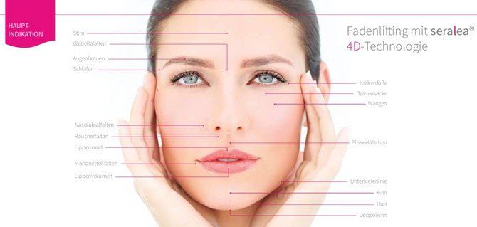 Fadenlifting, Mini Facelift, Seralea, Wangenlifting, Halslift, Kosten und Preise Fadenlifting, Mini Facelift, Seralea, Wangenlifting, Halslift, Kosten und Preise, Montabaur, Koblenz