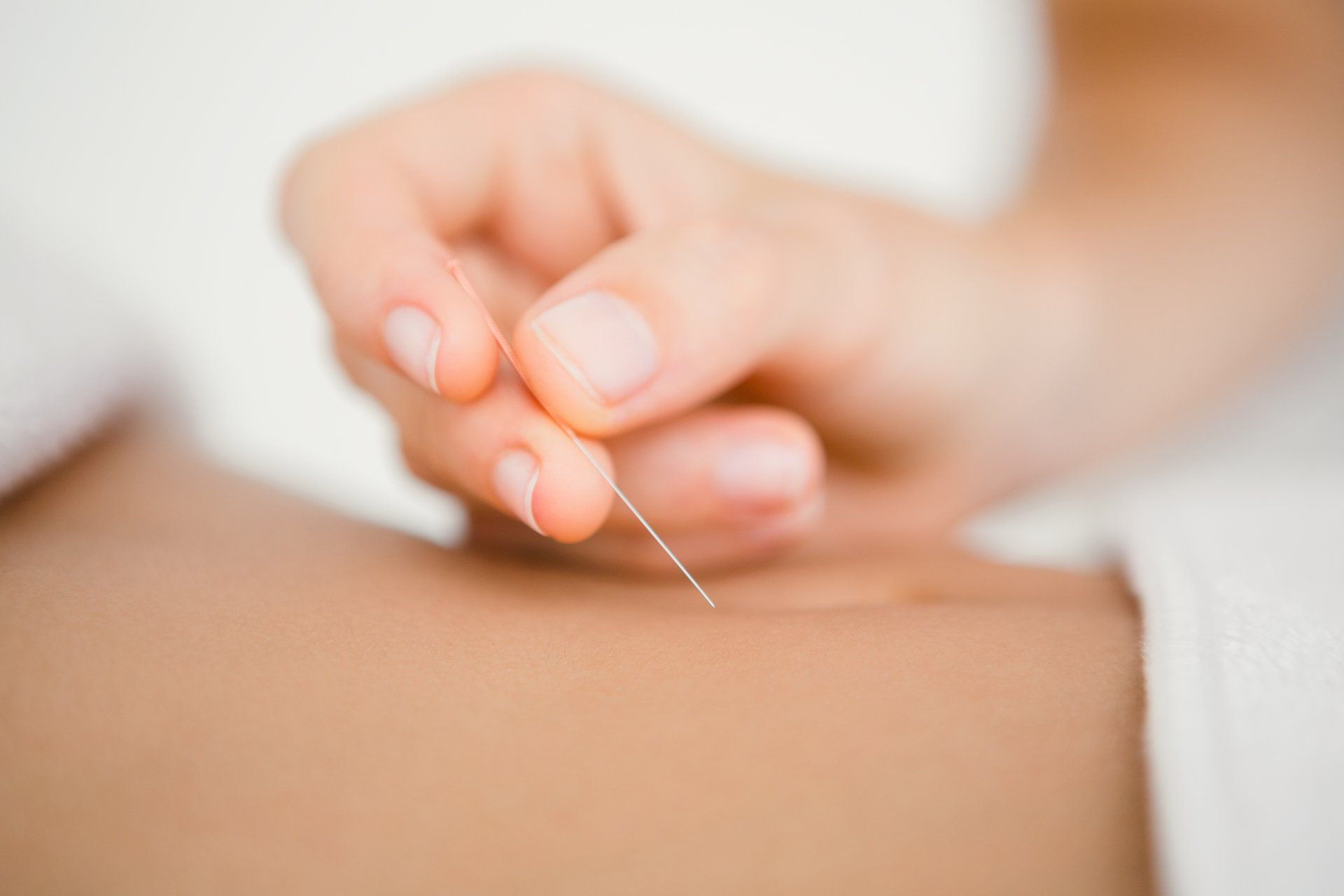 acupuncture march, acupuncture fenland, acupuncture wisbech, acupuncture fens, acupuncture whittlesey, acupuncture cambridgeshire, acupuncture cambs, acupuncture norfolk