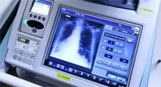 Medical Devices Including Scanners which Zener Engineering Services Validate