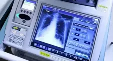 Medical Devices Validated By Zener Engineering Services Ltd Medical Devices Validated By Zener Engineering Services Ltd