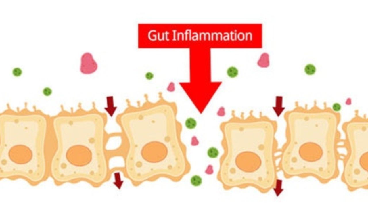 Image showing leaky gut tears in the small intestine.