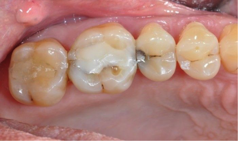 Vue clinique initiale Vue clinique initiale