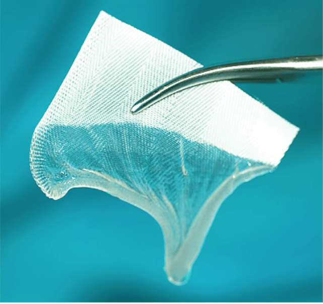bloodstop, dentingo, bloodstop ix, hämostatikum, matrix, wundheilung, Dental, Dentistry, Zahnarzt, Oralchirurgie, MKG, Extraktion, Sinuslift, Membran, Implantologie, Osteotomie,