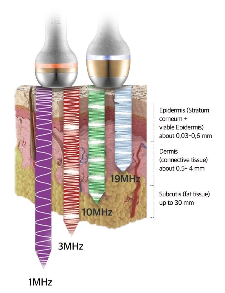 Eindringtiefen Ultraschall