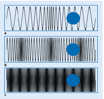 Zellen in LDM Ultraschall