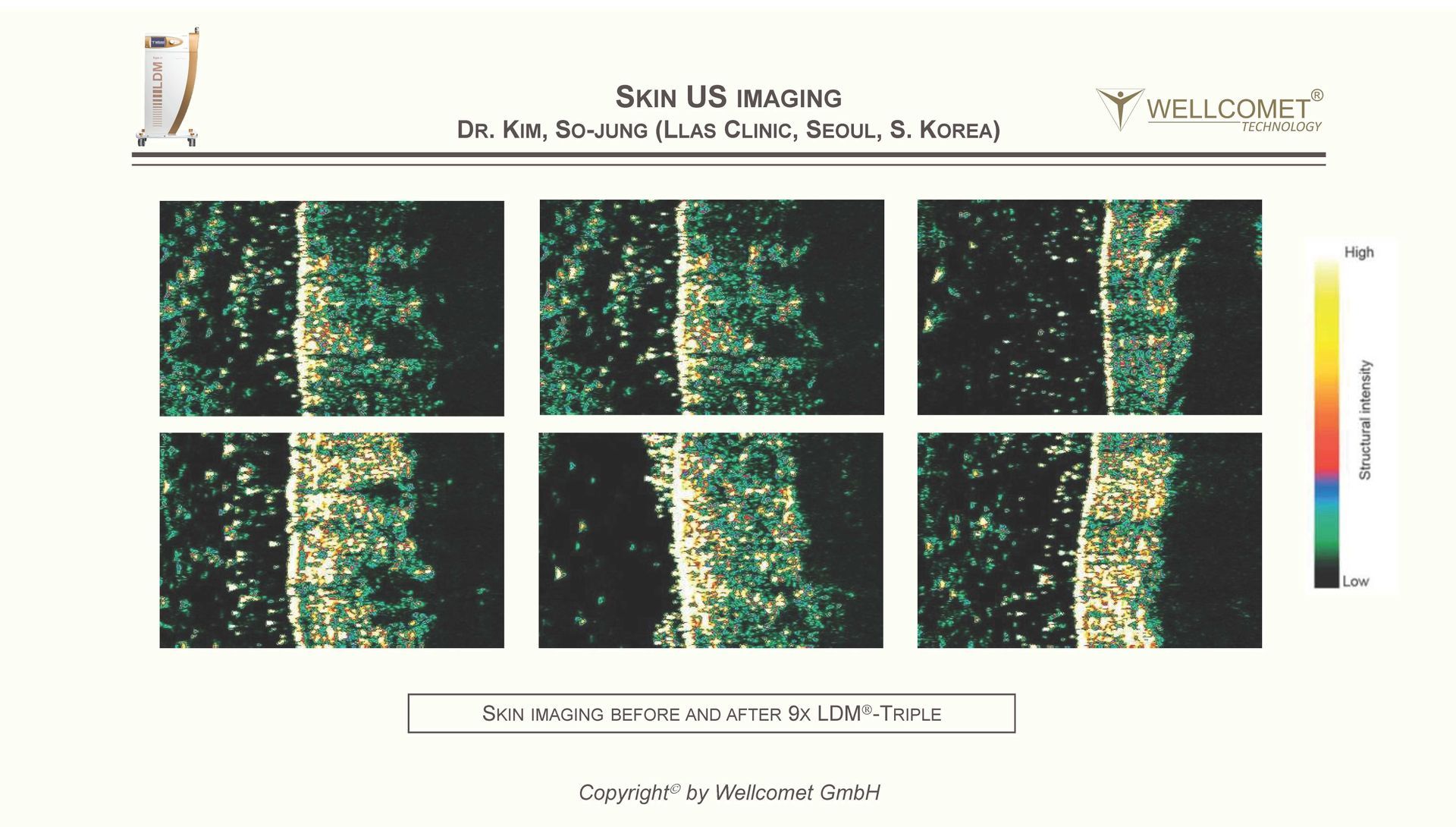Wellcomet Grenzschicht