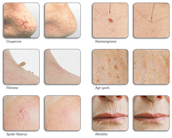 Vorher Nachher Onetec