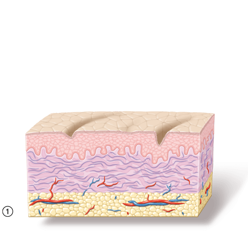 Bild1 zu Radiofrequenz Funktionsweise