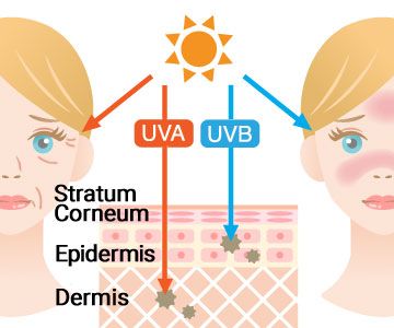 Schädliche Strahlen