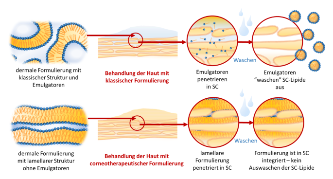 Prinzip des Hautschutzes durch Anwendung dermaler Produkte mit lamellarer Struktur Kosmetikstudio Kladow - Wash-Out Bild