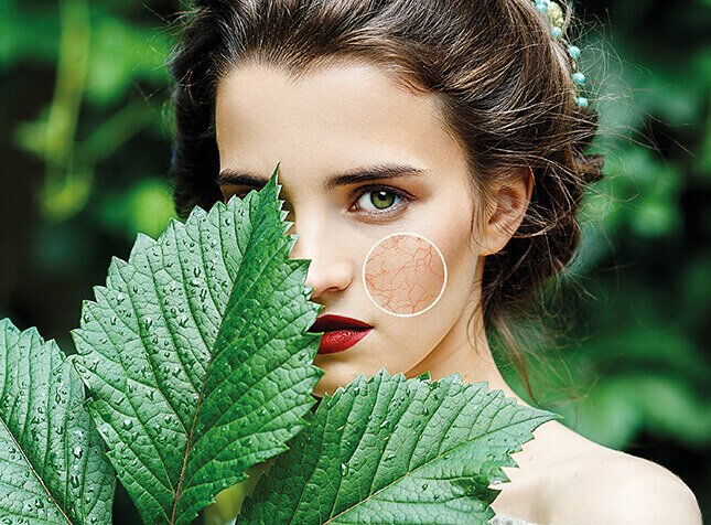 REDNESS CONTROL