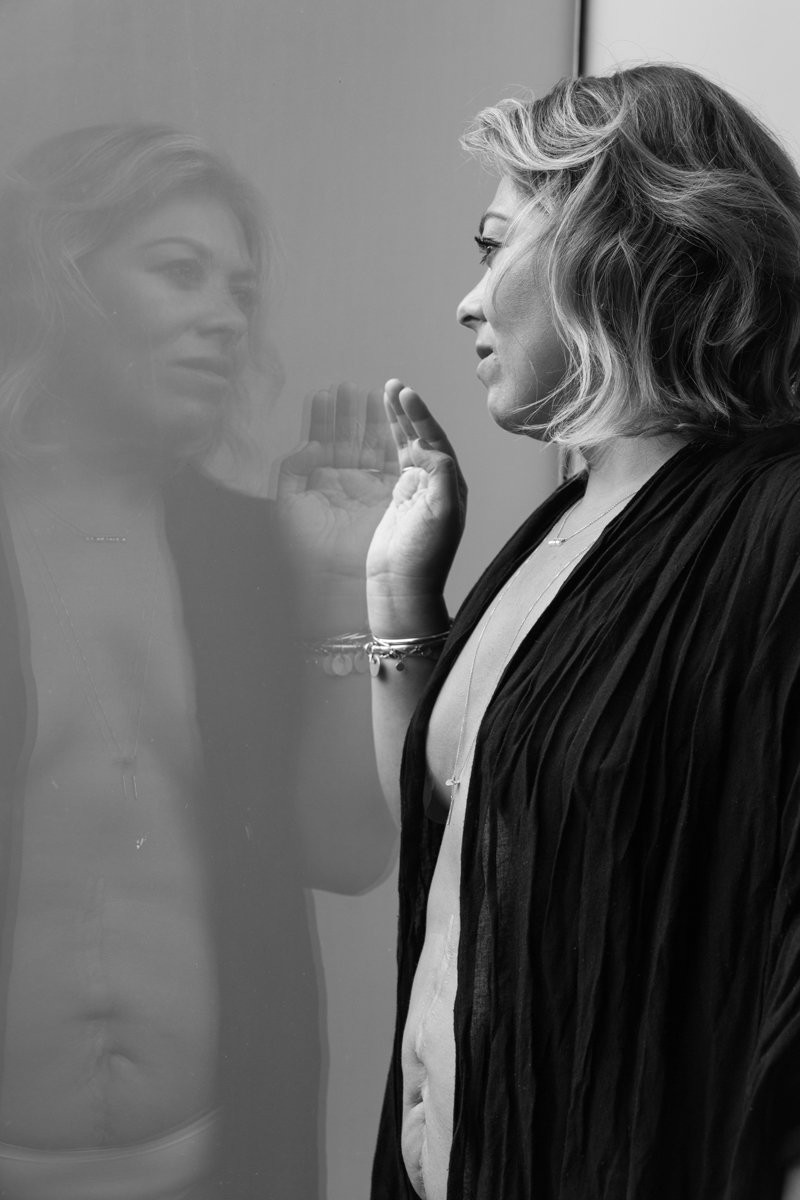 PROYECTO CICATRICES PERÚ CLAUDIA QUINTANA FOTOGRAFÍA DOCUMENTAL