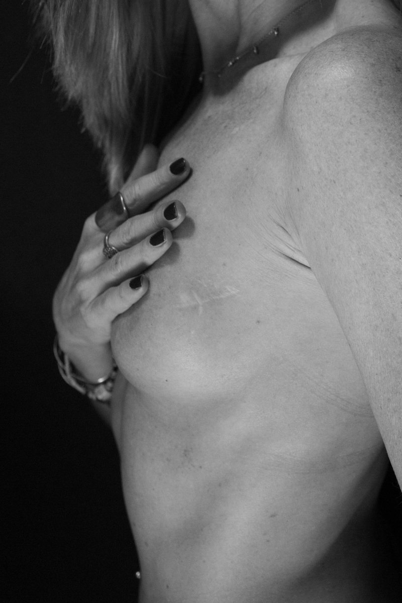 PROYECTO CICATRICES BARCELONA CLAUDIA QUINTANA FOTOGRAFÍA DOCUMENTAL