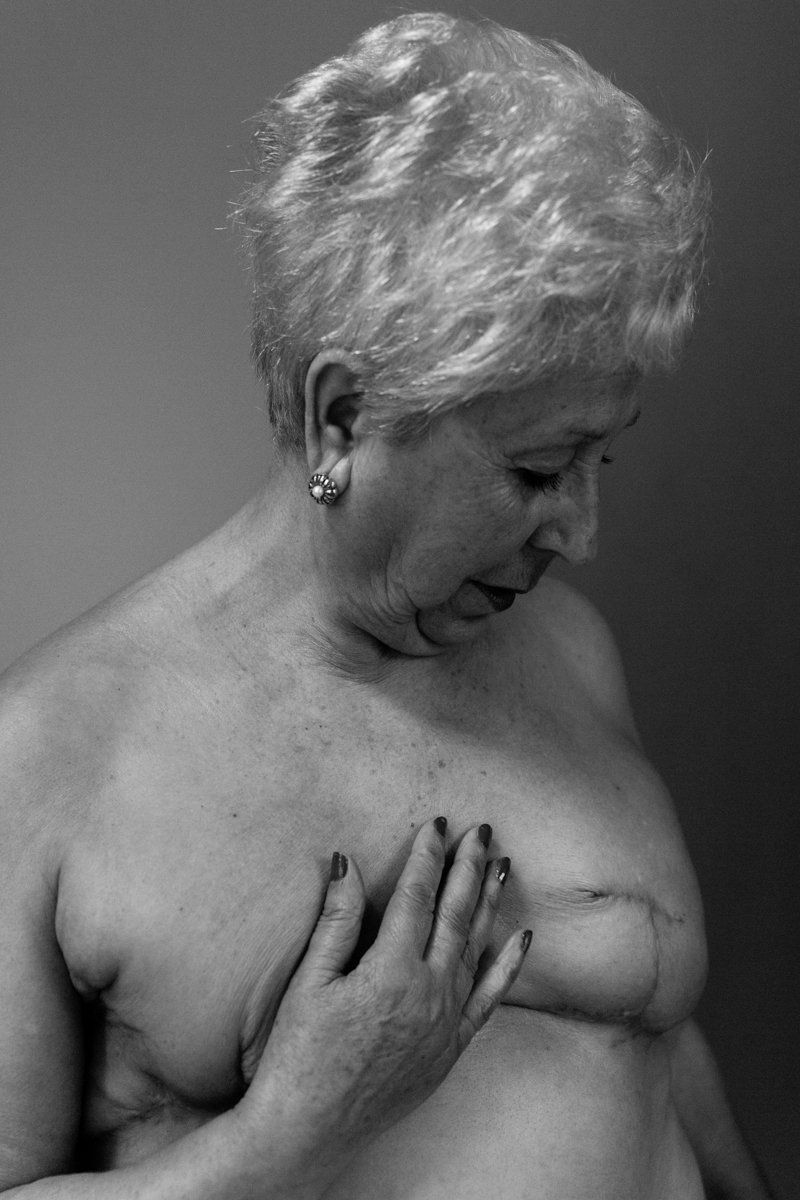 CICATRICES BARCELONA CLAUDIA QUINTANA FOTOGRAFÍA DOCUMENTAL