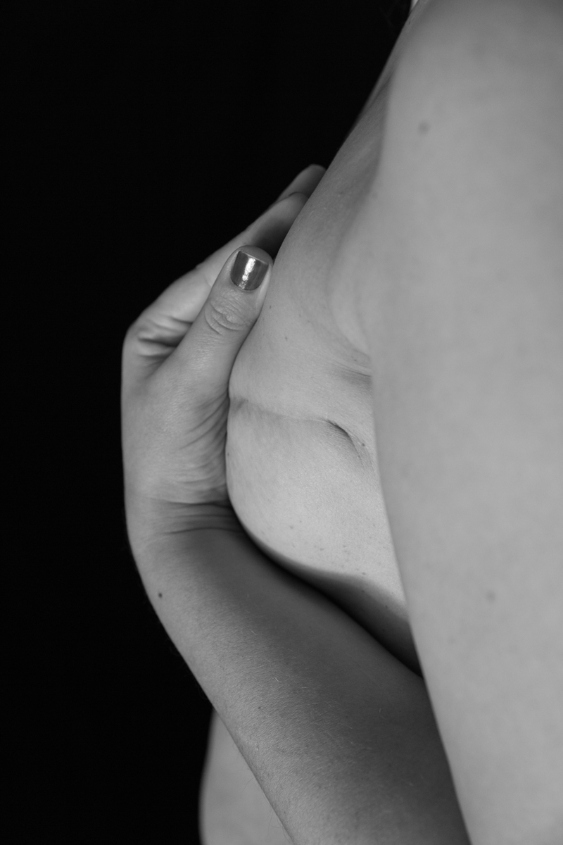 PROYECTO CICATRICES BARCELONA CLAUDIA QUINTANA FOTOGRAFÍA DOCUMENTAL