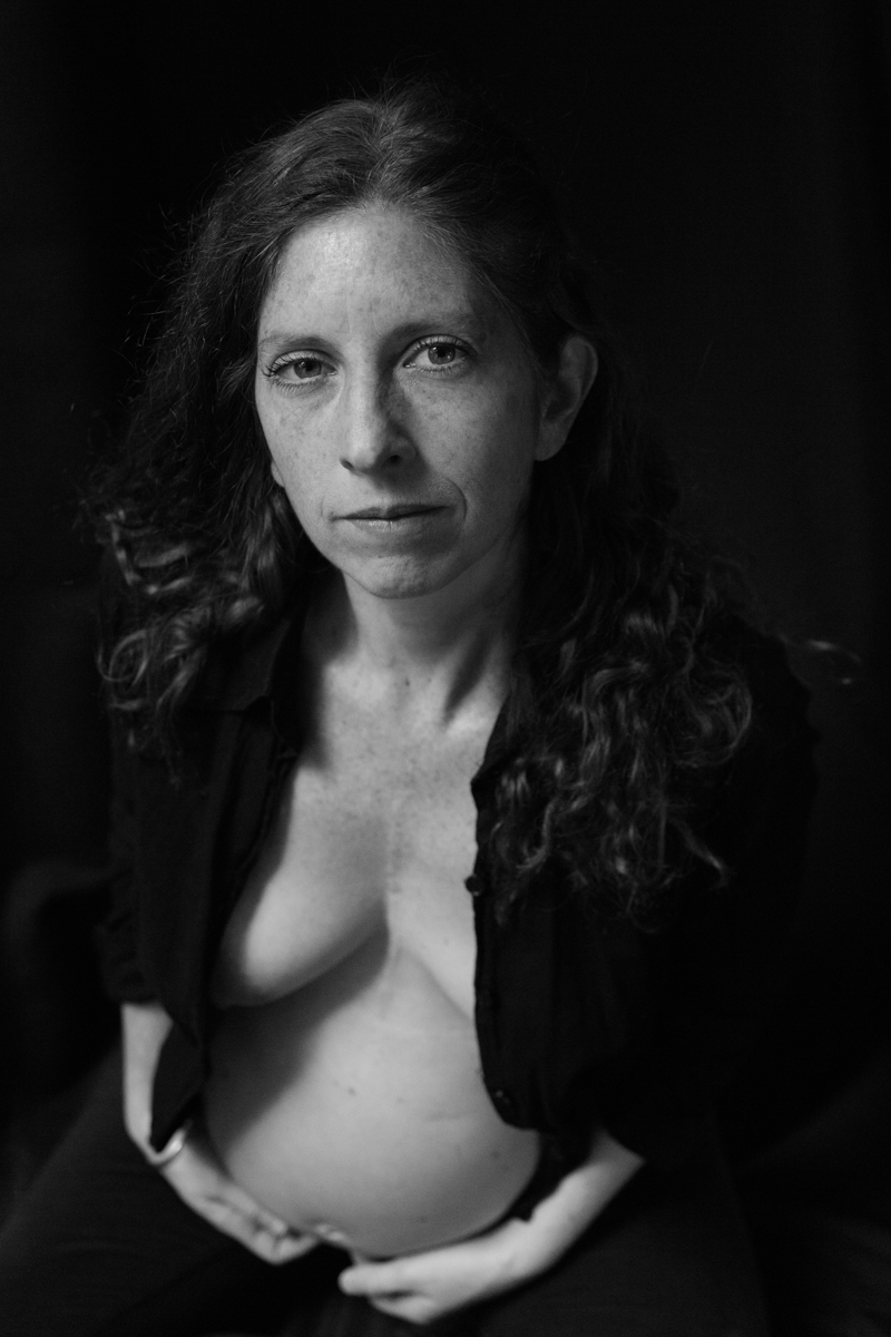 PROYECTO CICATRICES BARCELONA CLAUDIA QUINTANA FOTOGRAFÍA DOCUMENTAL