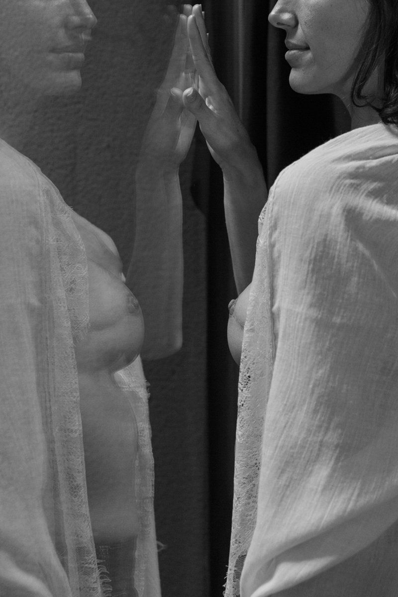 PROYECTO CICATRICES BARCELONA CLAUDIA QUINTANA FOTOGRAFÍA DOCUMENTAL