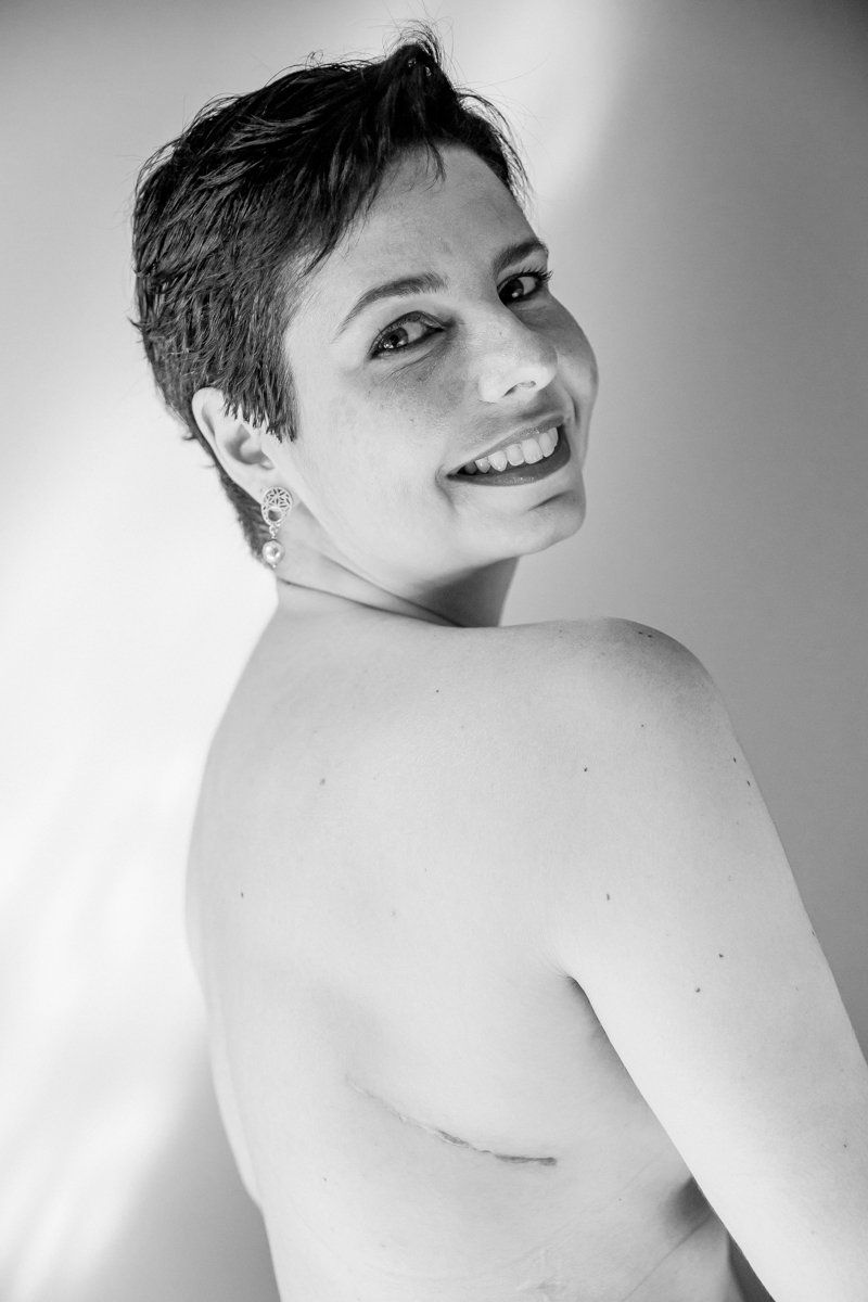 SCARS-CICATRICES LIMA CLAUDIA QUINTANA DOCUMENTARY PHOTOGRAPHY. JULIANA COLON CANCER