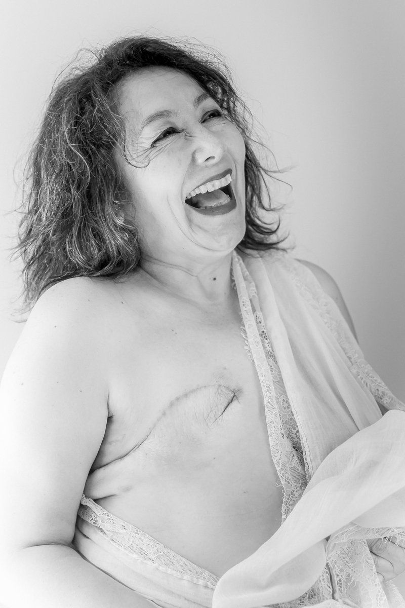 SCARS-CICATRICES LIMA CLAUDIA QUINTANA DOCUMENTARY PHOTOGRAPHY. OLYMPIA BREAST CANCER