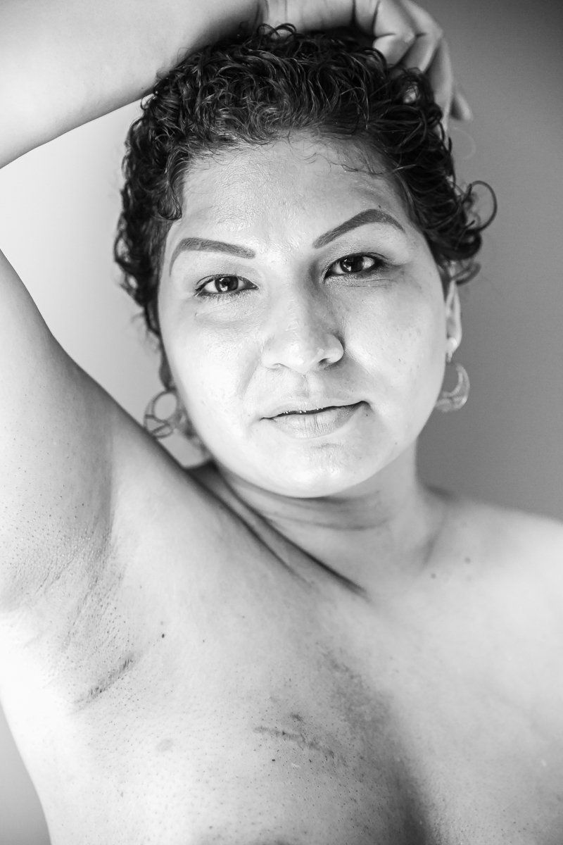 CICATRICES LIMA CLAUDIA QUINTANA FOTOGRAFÍA DOCUMENTAL. YENNY CÁNCER DE MAMA TRIPLE NEGATIVO