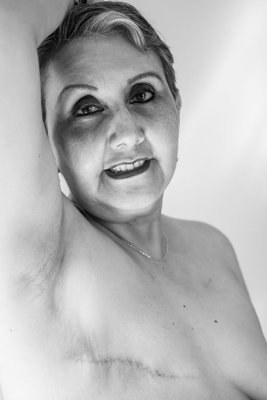 SCARS-CICATRICES LIMA CLAUDIA QUINTANA DOCUMENTARY PHOTOGRAPHY. SUSANA BREAST CANCER