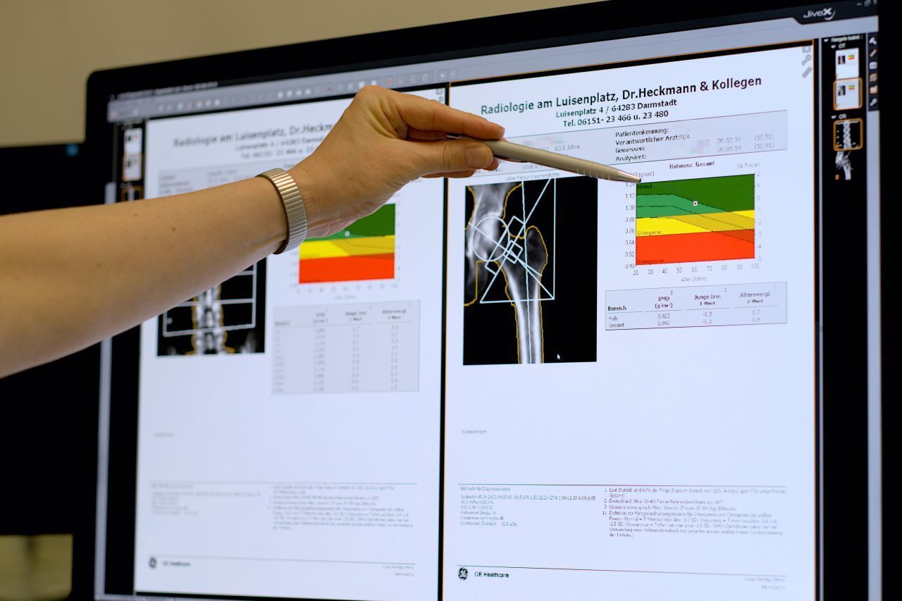 Knochendichtemessung Knochendichtemessung Befunddemonstration