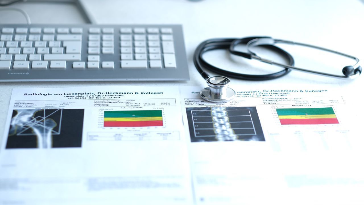 Knochendichtemessung DXA Knochendichtemessung DXA