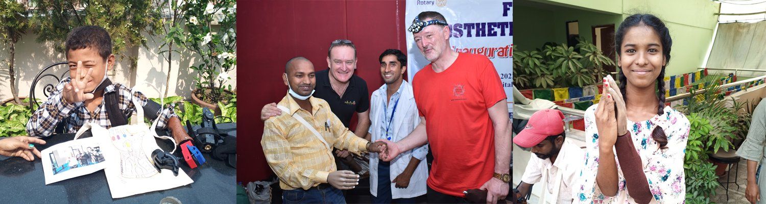 The Hand Project kostenlose Handprothesen 3. Welt