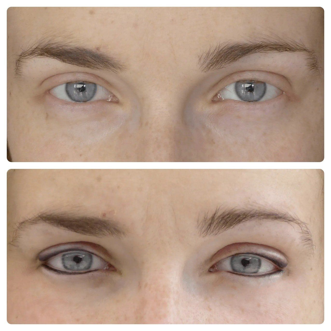 dermopigmentation médicale, tricotillomanie