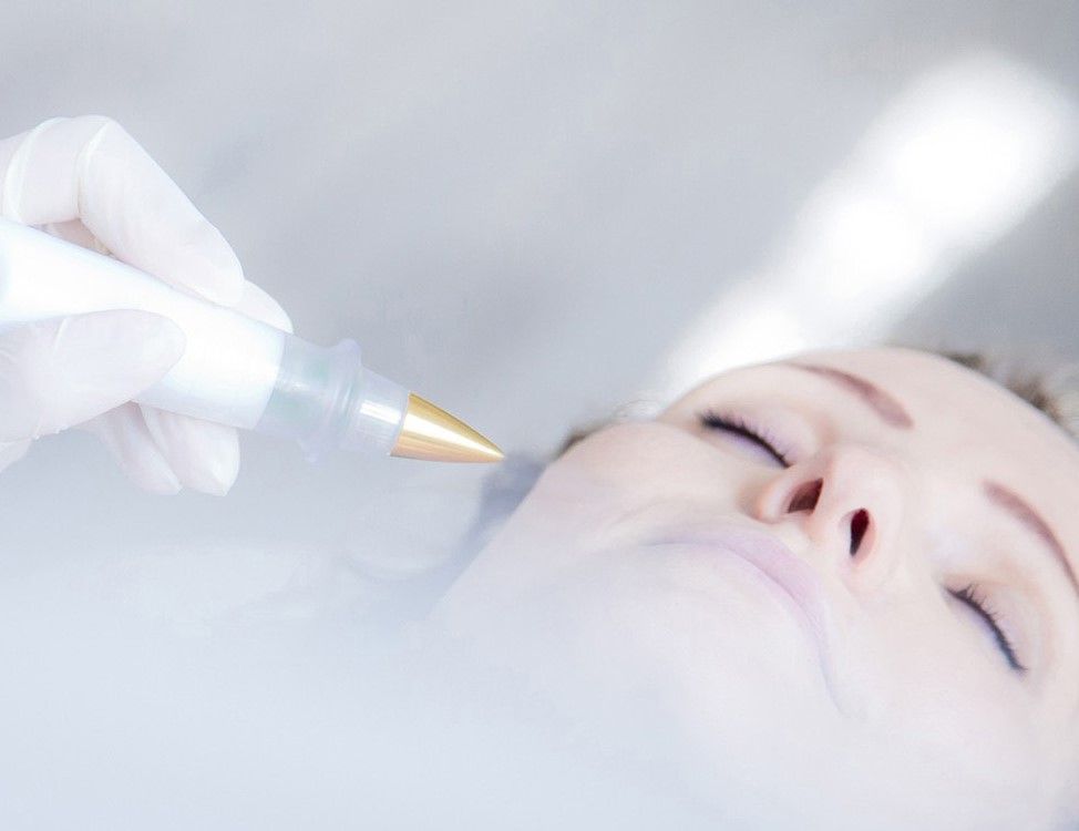 traiter le relâchement cutané avec la technologie plasma, méthode anti-rides, lifting sans chirurgie