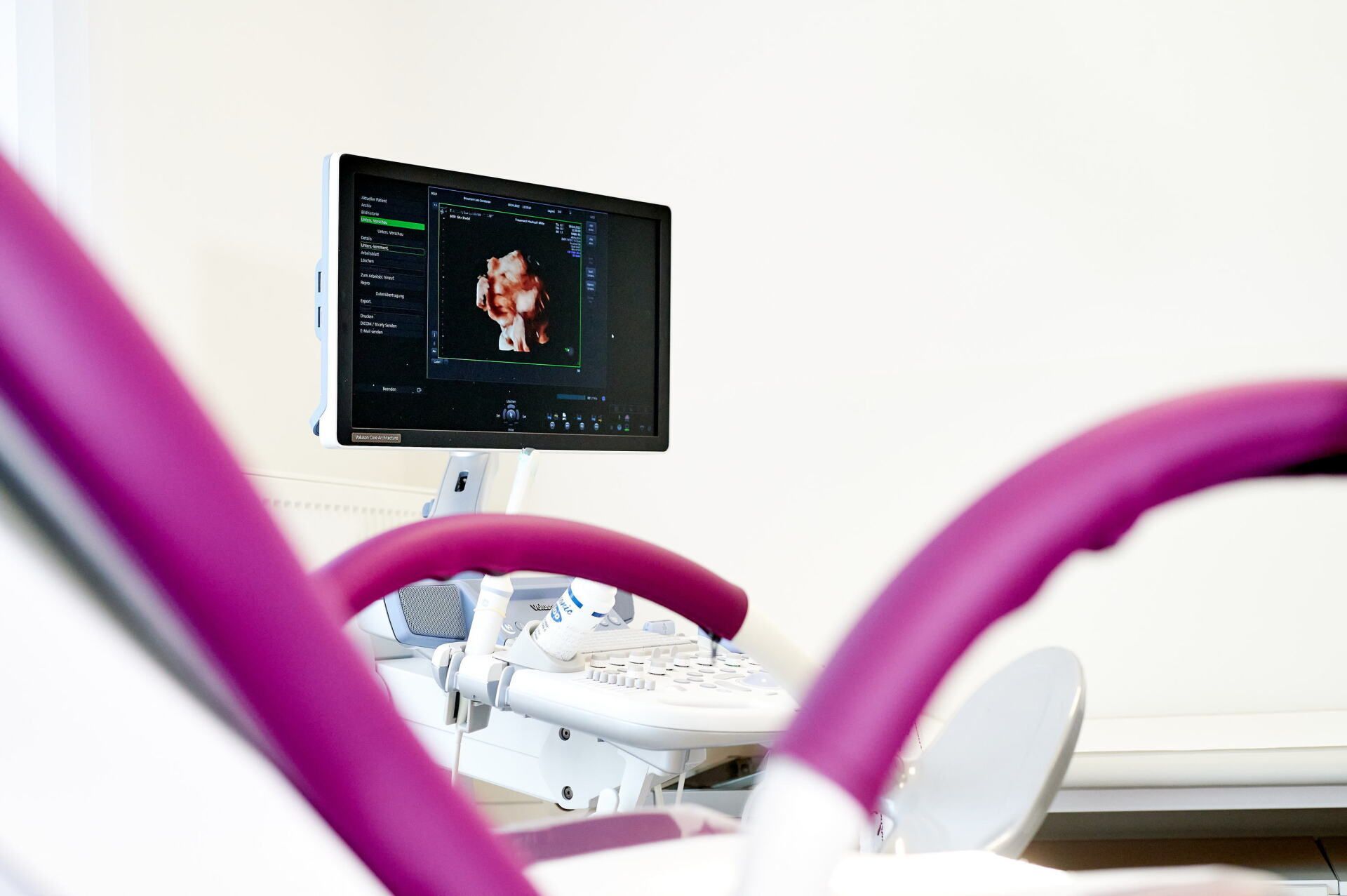 MonaLisa Touch® Frauenheilkunde