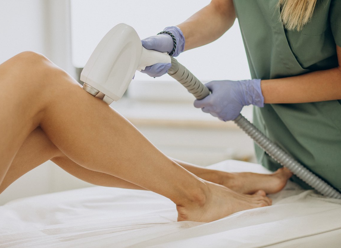 Laser-haarentfernung, Laser Haarentfernung, dauerhafte Haarentfernung