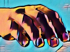 Karpaltunnelsyndrom Hand Karpaltunnelsyndrom Hand
