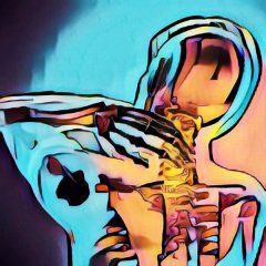 Rückenschmerzen Halswirbelsäule HWS Rückenschmerzen Halswirbelsäule HWS