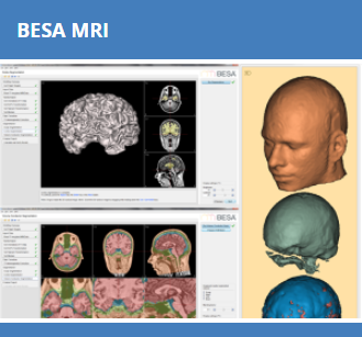 BESA MRI 3.0