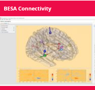 BESA CONNECTIVITY 2.0