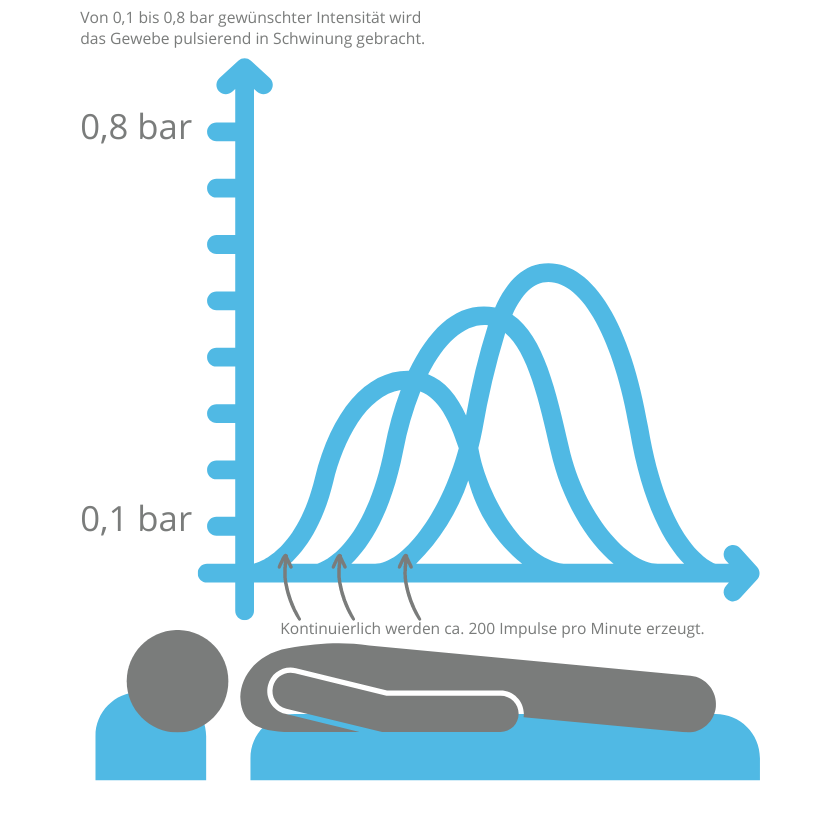 Infografik Patient auf einer blauen Liege Diagramm Darstellung von 0,1 bis 0,8 bar Pulsation mit grafisch dargestellten Ampllituden
