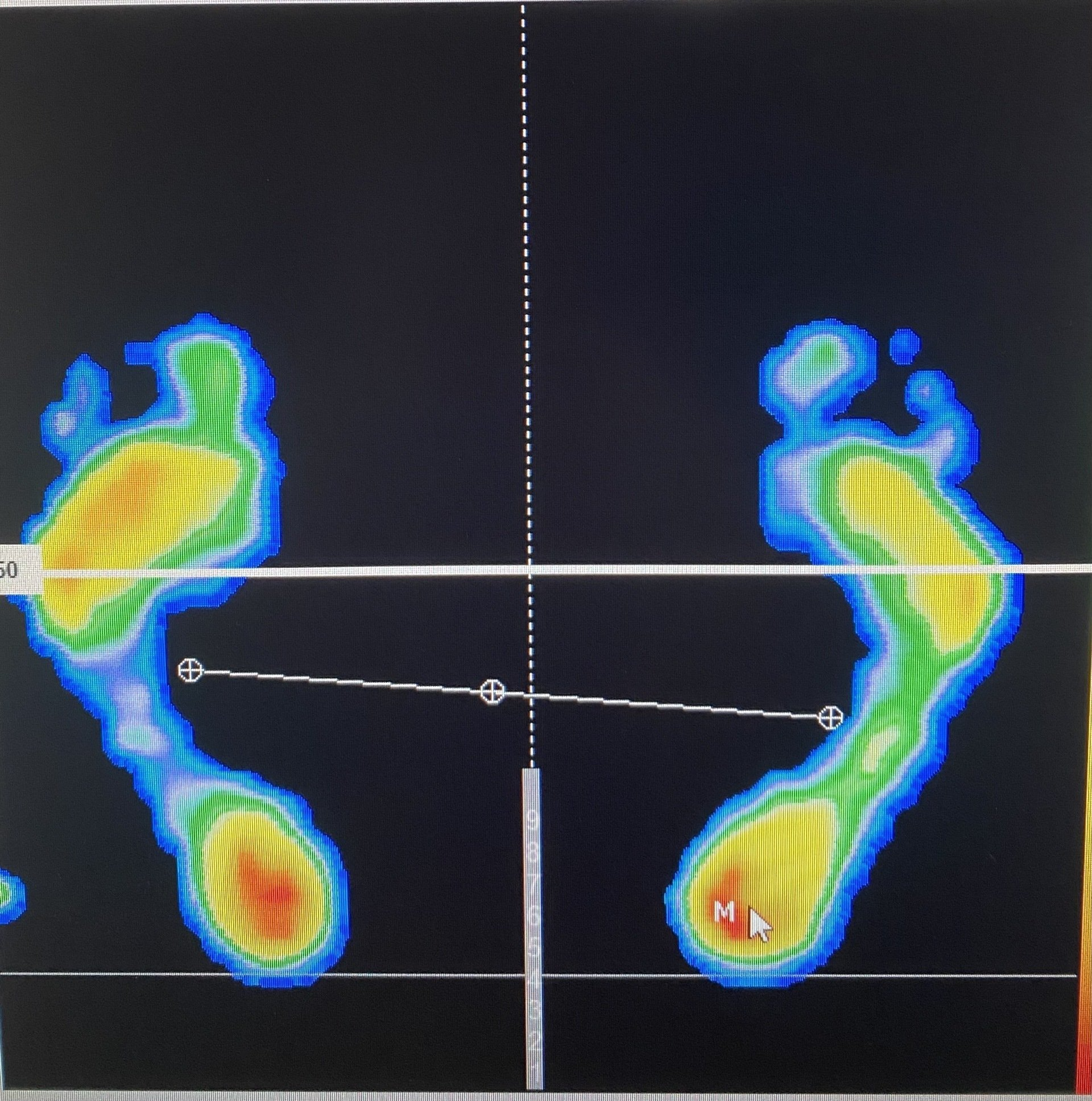 analyse statique et dynamique sur plateforme de pression