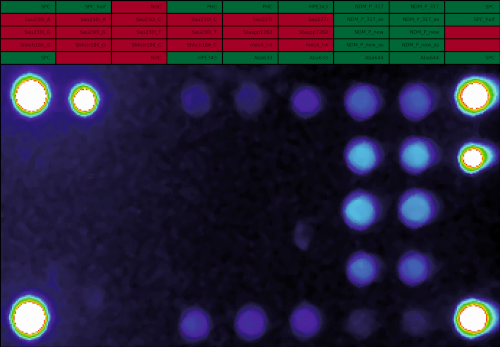 Falschfarben-Fluoreszenzbild (A. baumannii mit NDM-Resistanz)