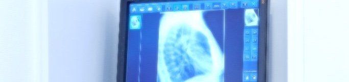 Röntgenbild einer Lunge