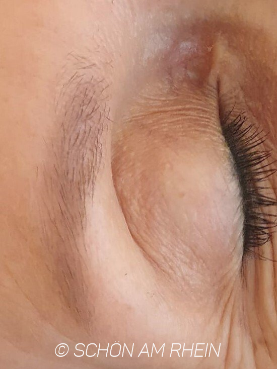 Browlifting Browlamination vorher