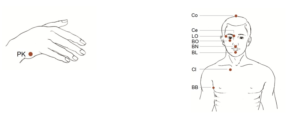 Imagenes extraída de la página oficial del Dr. gary craig