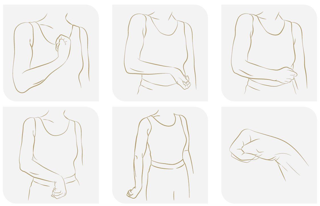 So kann eine Spastik am Arm aussehen Armspastik