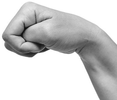 So kann eine Spastik am Arm aussehen Armspastik