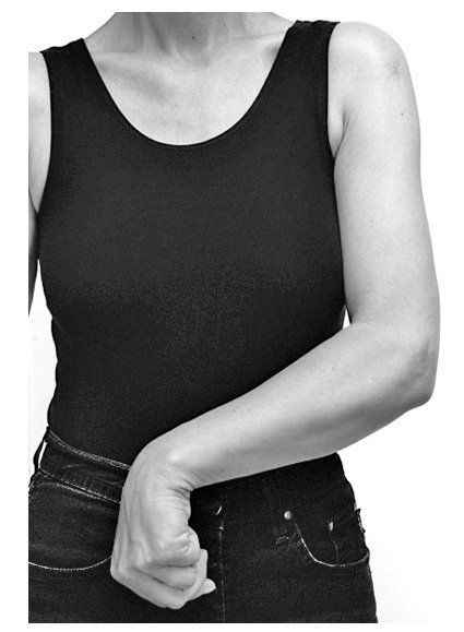 So kann eine Spastik am Arm aussehen Armspastik