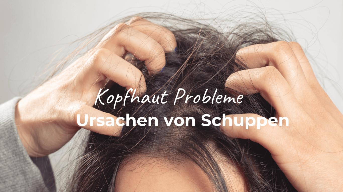 Hände die eine offensichtlich juckende Kopfhaut kratzen. Daneben der Schriftzug