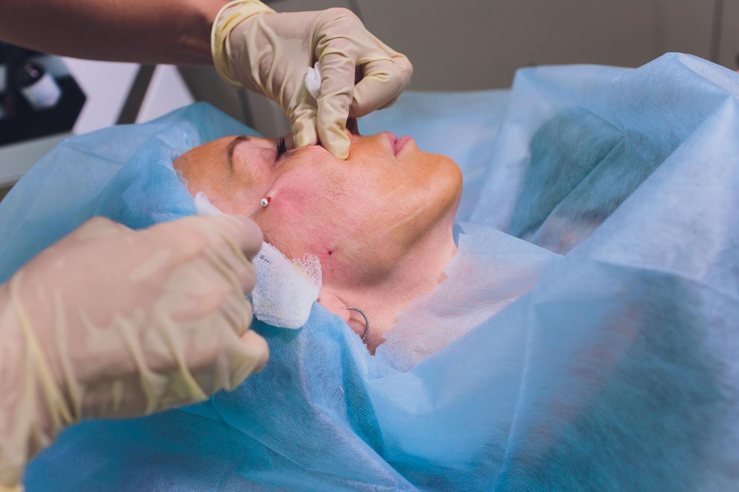 complication en medecine esthetique