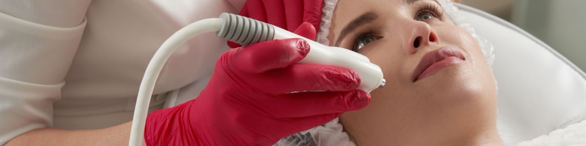 la radiofrequence sur les rides