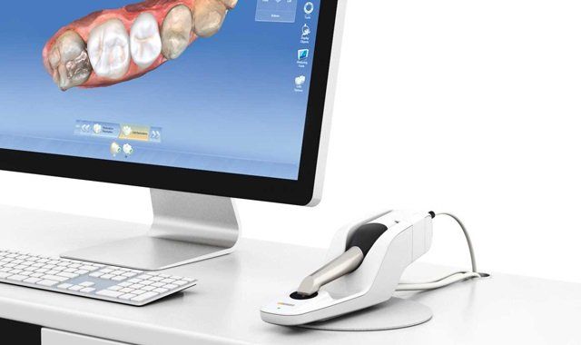 Bruxismo. Prótesis digital. Clínica Dental Cámara. Dentista en Granada. Dentista en Jaén.