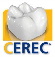 Cerec: diseño digital de prótesis dentales. Clínica Dental Cámara. Dentista en Granada. Dentista en Jaén.